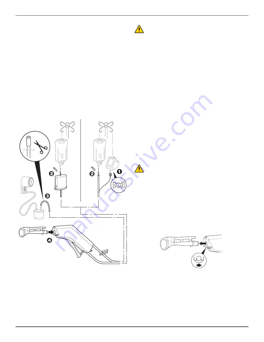 Stryker InterPulse 0210 000 Series Instructions For Use Manual Download Page 61