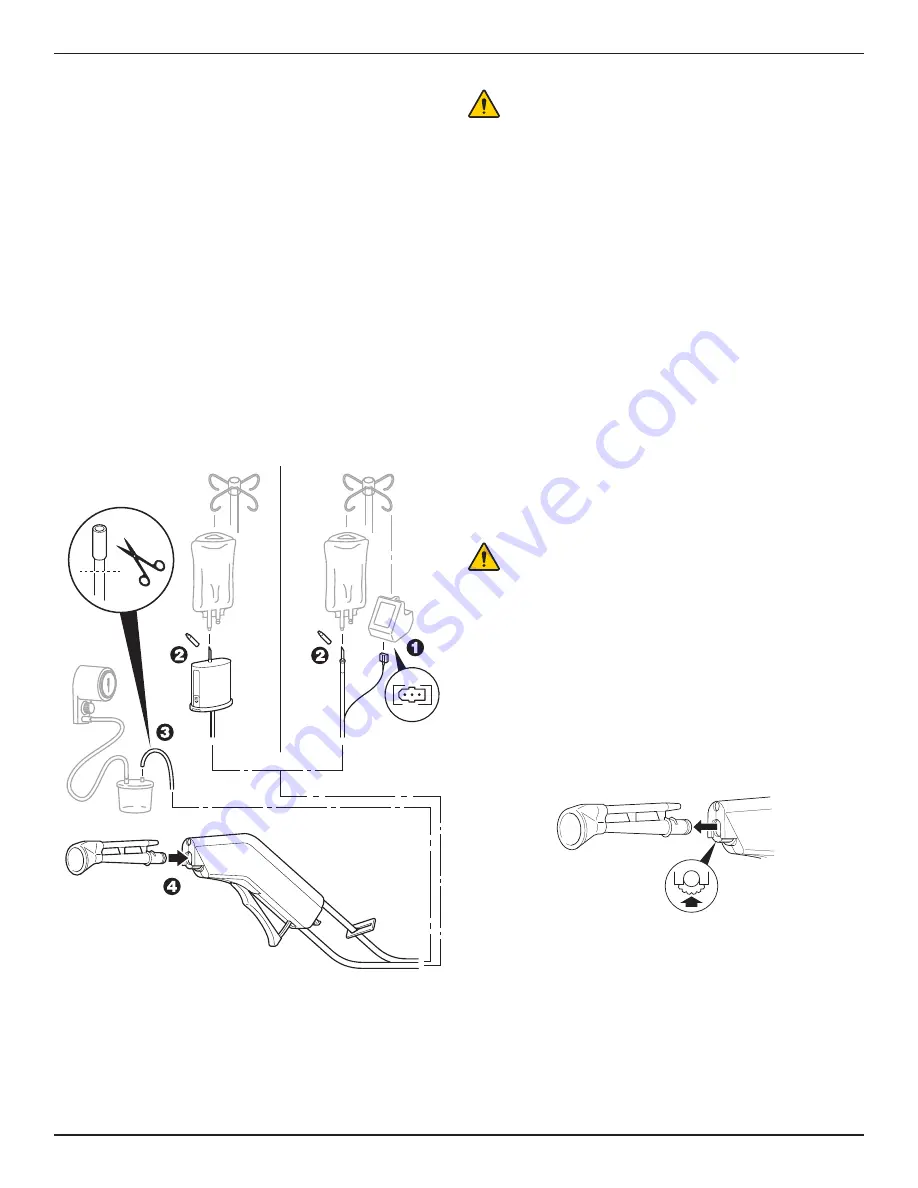 Stryker InterPulse 0210 000 Series Instructions For Use Manual Download Page 96