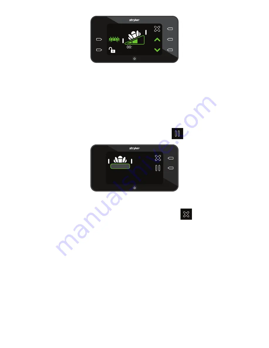 Stryker IsoTour Standard 2874 Operation Manual Download Page 455