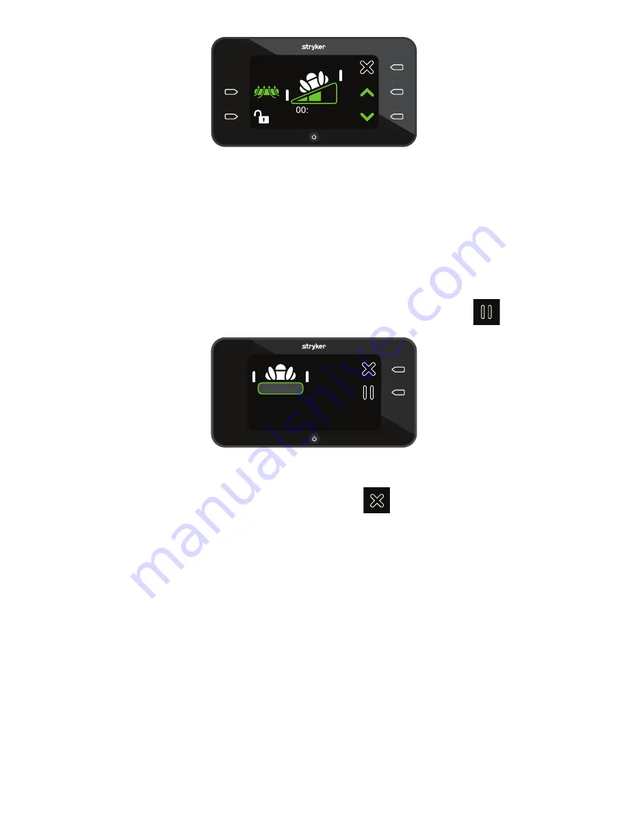 Stryker IsoTour Standard 2874 Operation Manual Download Page 645