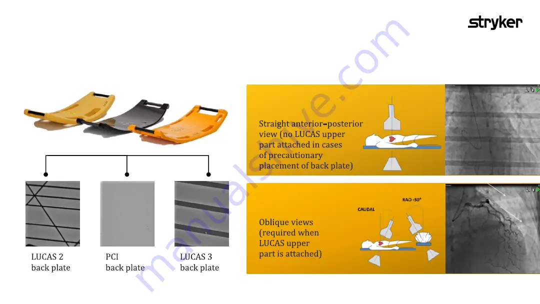 Stryker LUCAS 3 v3.1 Orientation Manual Download Page 21