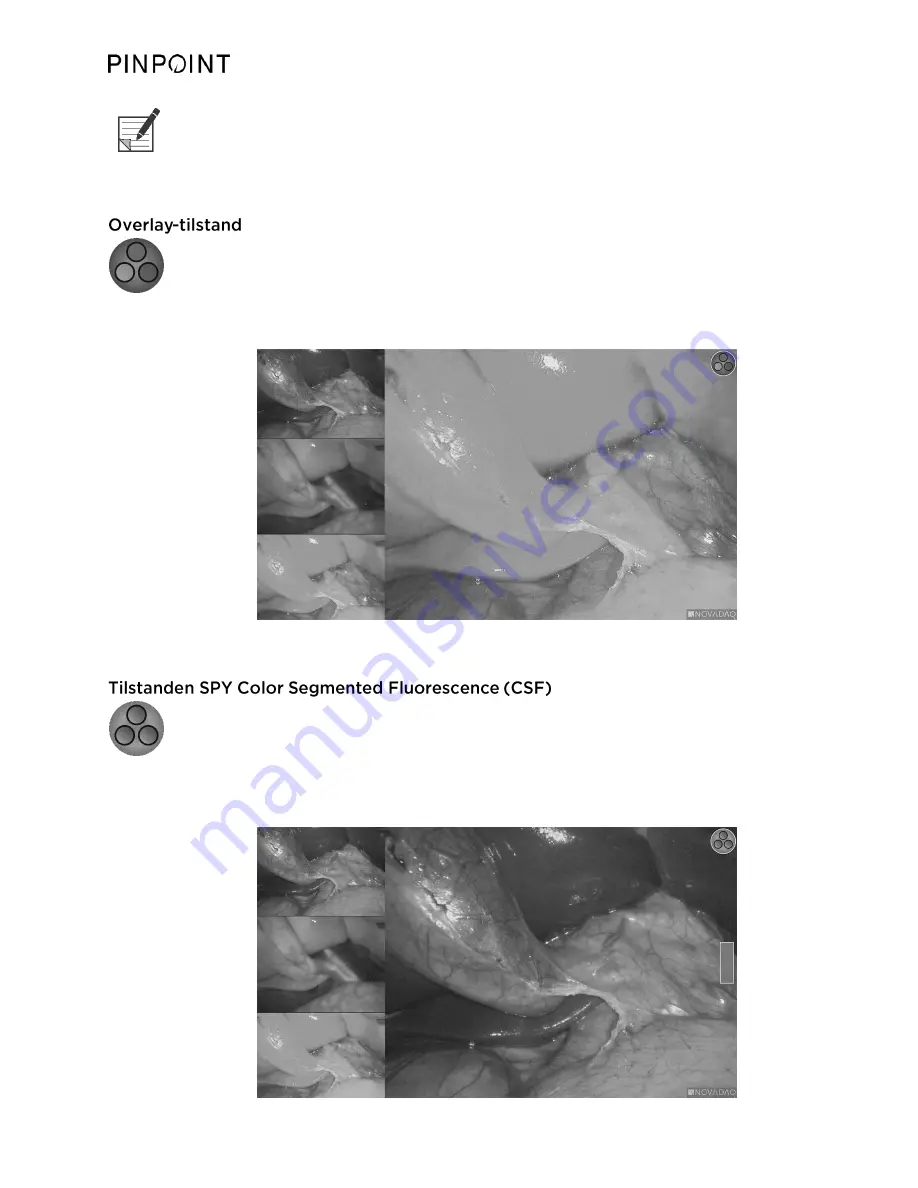 Stryker PINPOINT PC9000 Operator'S Manual Download Page 764