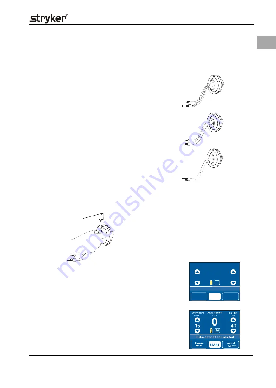 Stryker PneumoSure Instructions For Use Manual Download Page 25