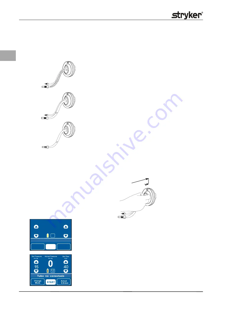 Stryker PneumoSure Instructions For Use Manual Download Page 126