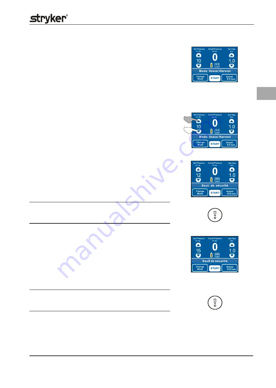 Stryker PneumoSure Instructions For Use Manual Download Page 263