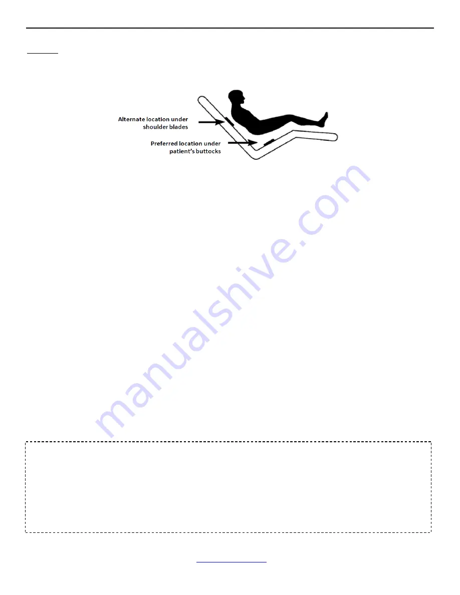 Stryker Reprocessed Stanley Bed Alarm Sensor Pad Instructions For Use Download Page 2