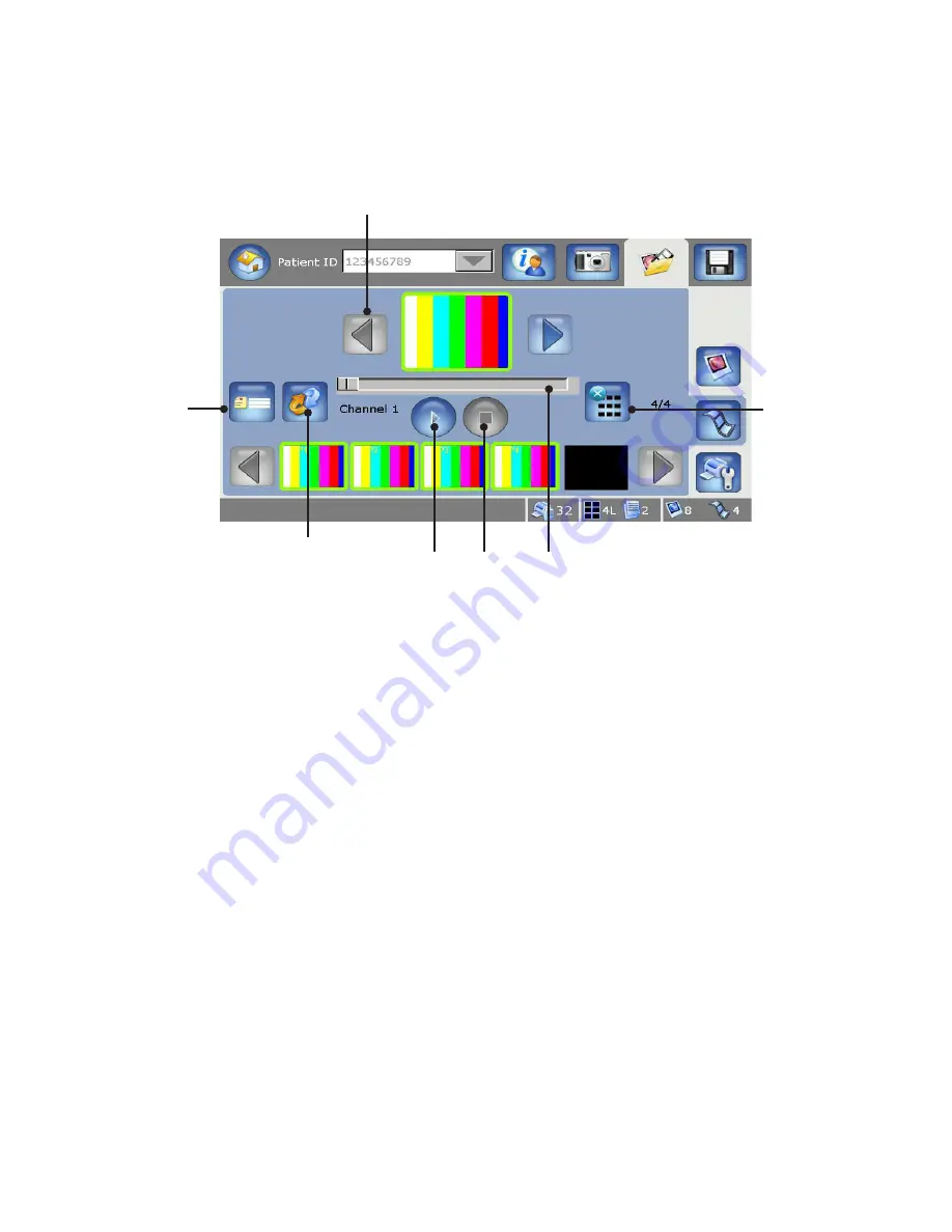 Stryker SDC Ultra User Manual Download Page 1033