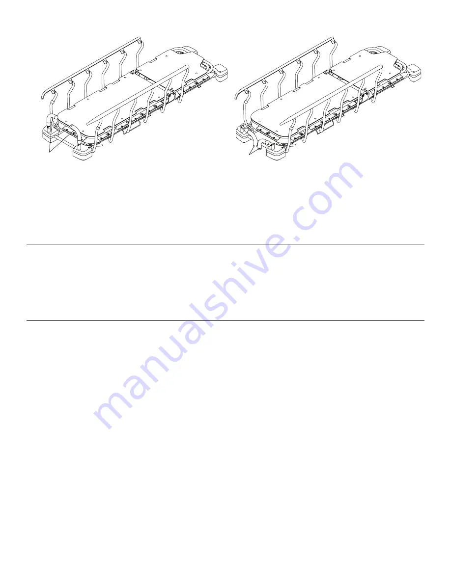 Stryker ST1 6300 Operation Manual Download Page 336