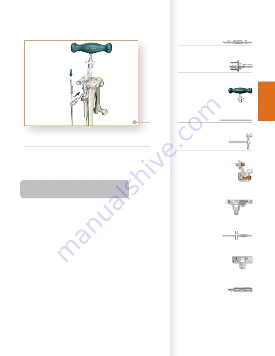 Stryker Triathlon Tritanium Surgical Manualline Download Page 27