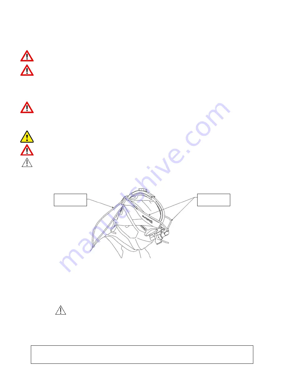 Sunoptic Surgical Titan X300 Operator'S Manual Download Page 94