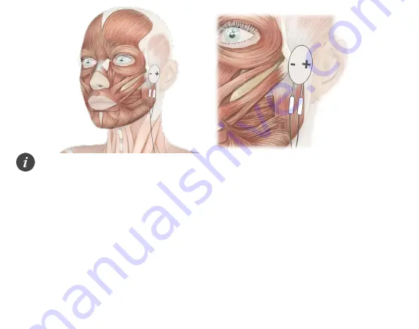 TensCare E-CM3050 Instructions For Use Manual Download Page 13