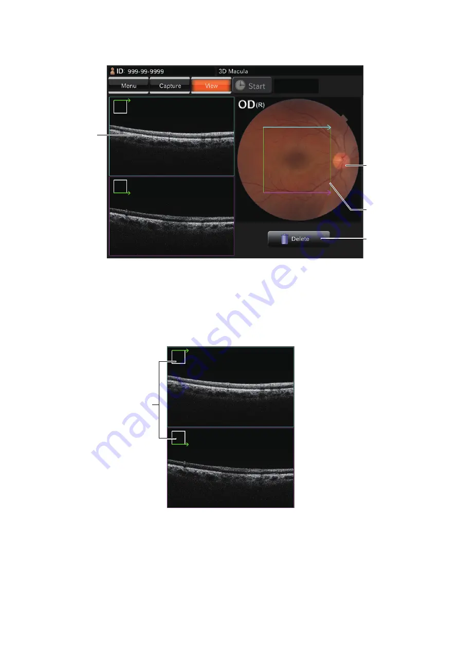 Topcon DRI OCT-1 Triton User Manual Download Page 26