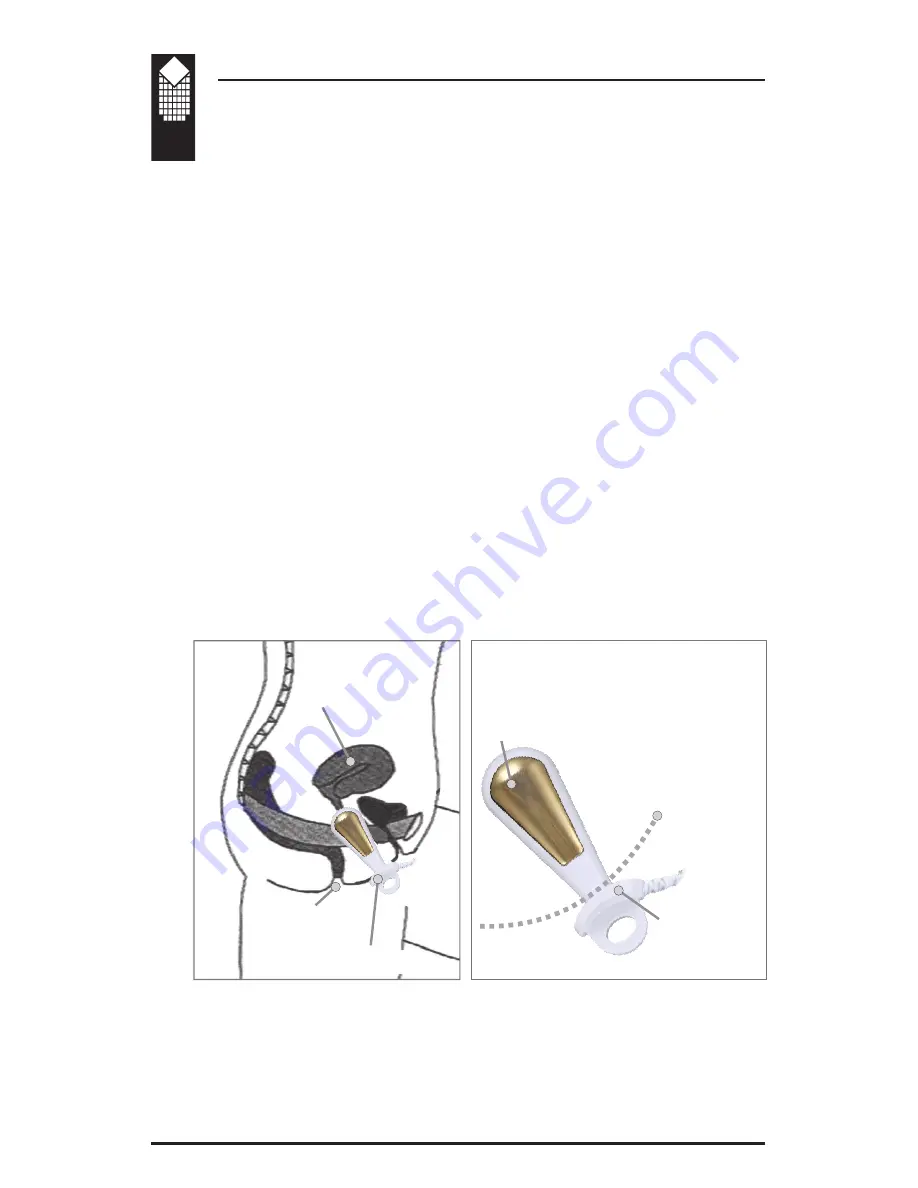 Verity Medical NeuroTrac Continence Operation Manual Download Page 8