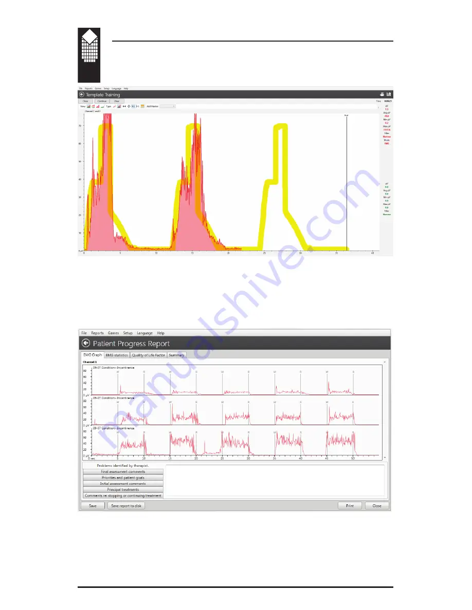 Verity Medical NeuroTrac Simplex Operation Manual Download Page 14