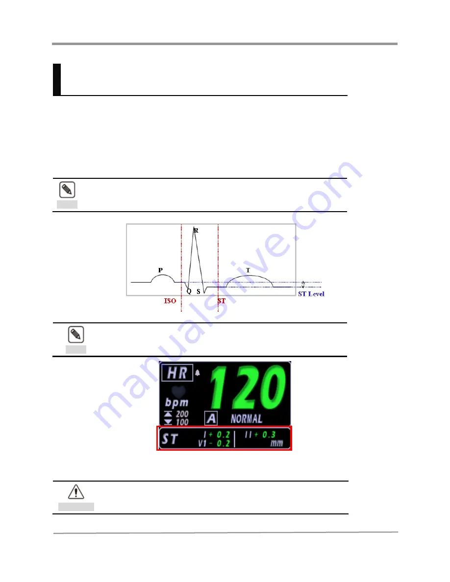 Vetland V1410 User Manual Download Page 59