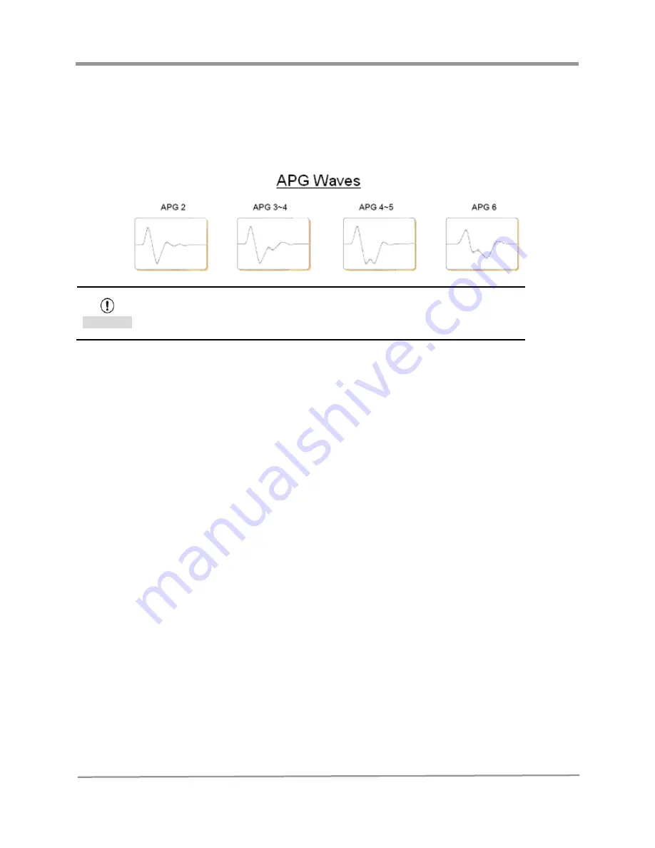 Vetland V1410 User Manual Download Page 79