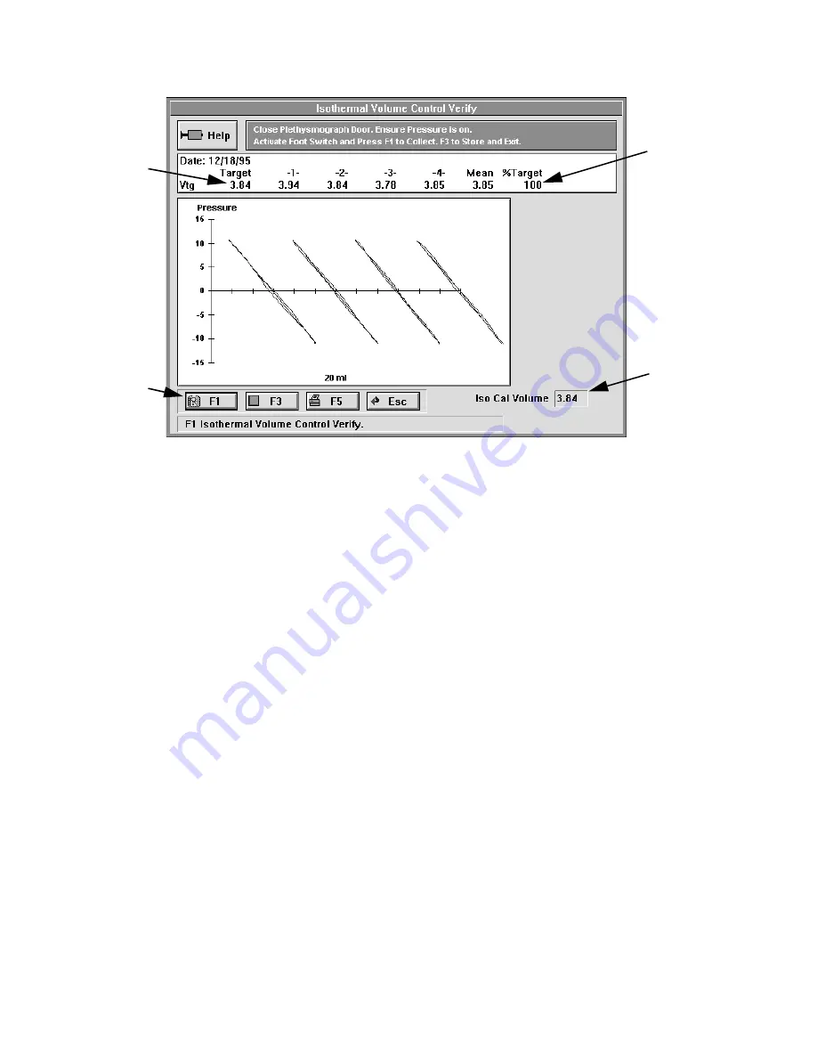 VIASYS Vmax Encore Technical Reference Manual Download Page 60