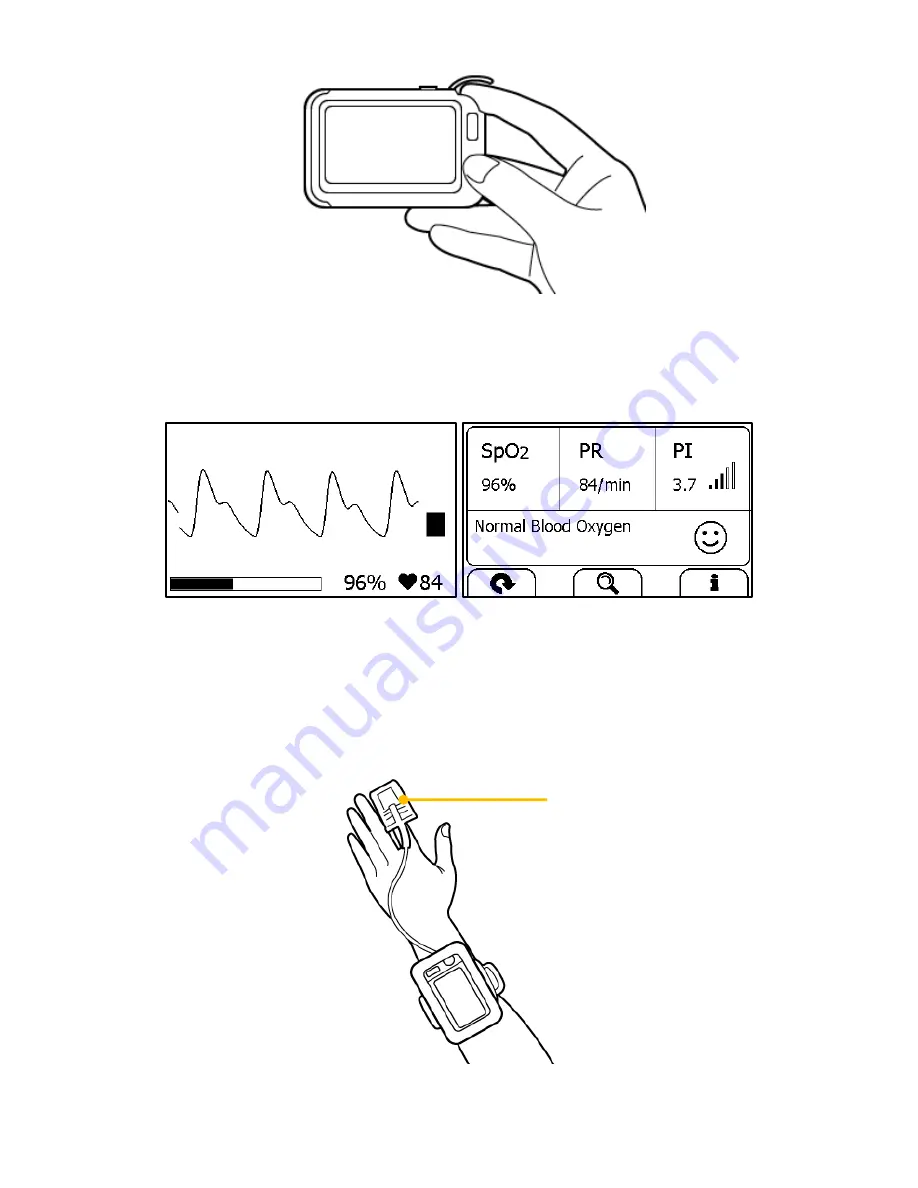 Viatom Checkme User Manual Download Page 21