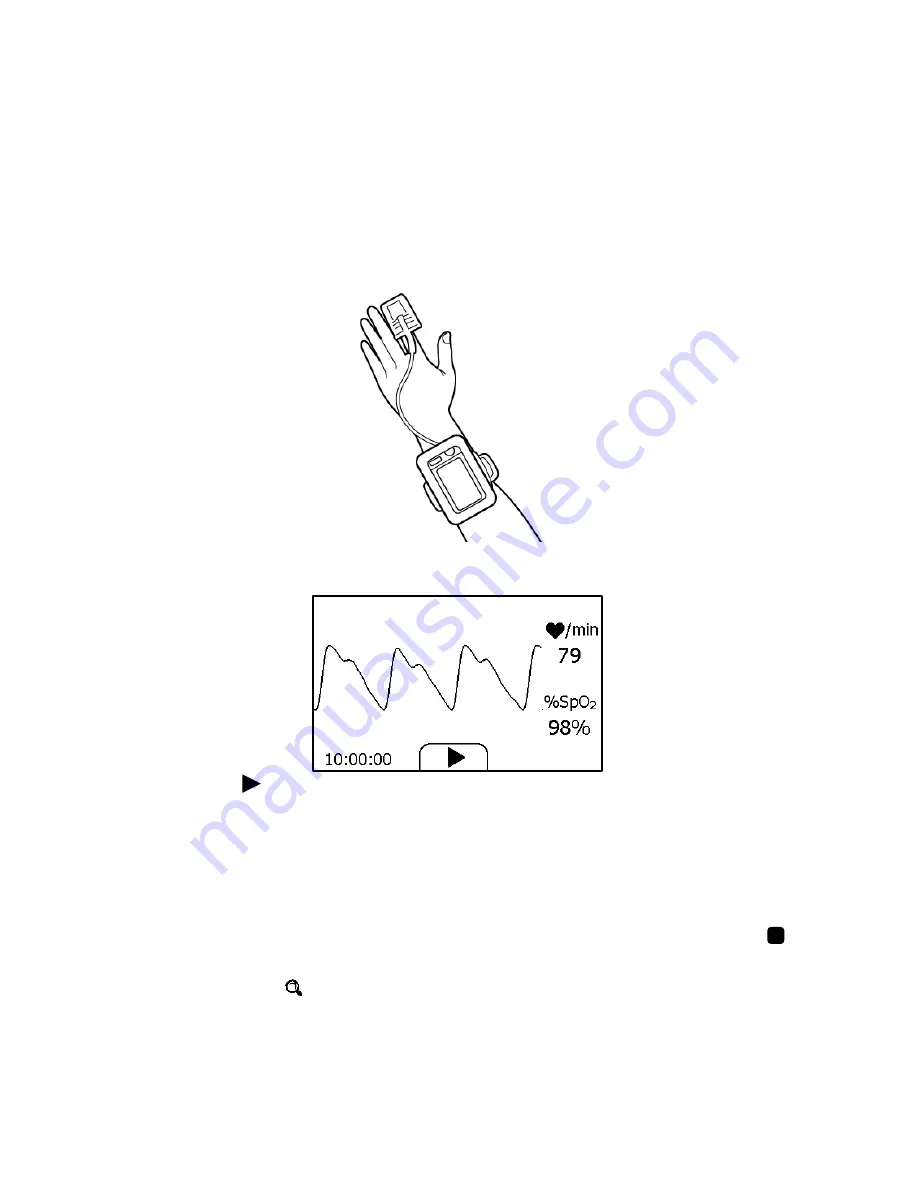 Viatom Checkme User Manual Download Page 25