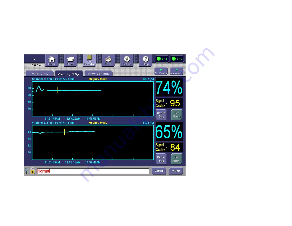 ViOptix T.Ox OXY-2-USM-1 Operator'S Manual Download Page 43