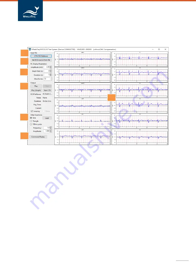 WHALETEQ MECG 2.0 User Manual Download Page 22