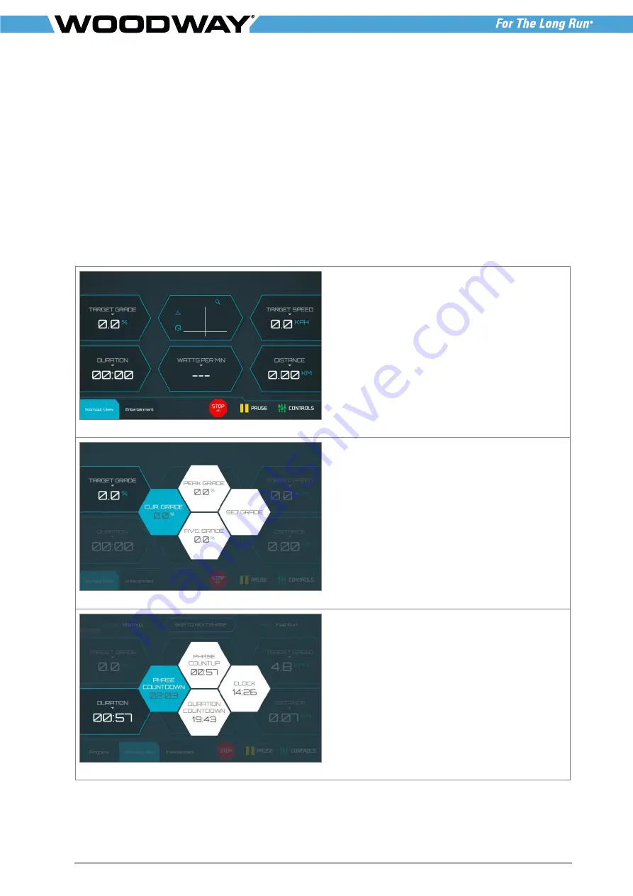 Woodway ProSmart Console 10.1