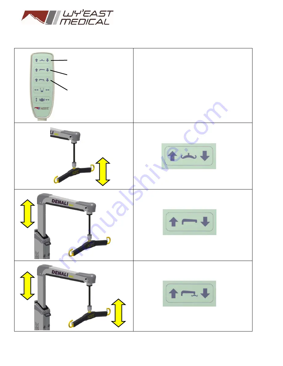 WY'EAST MEDICAL DENALI 600 52300 Скачать руководство пользователя страница 13