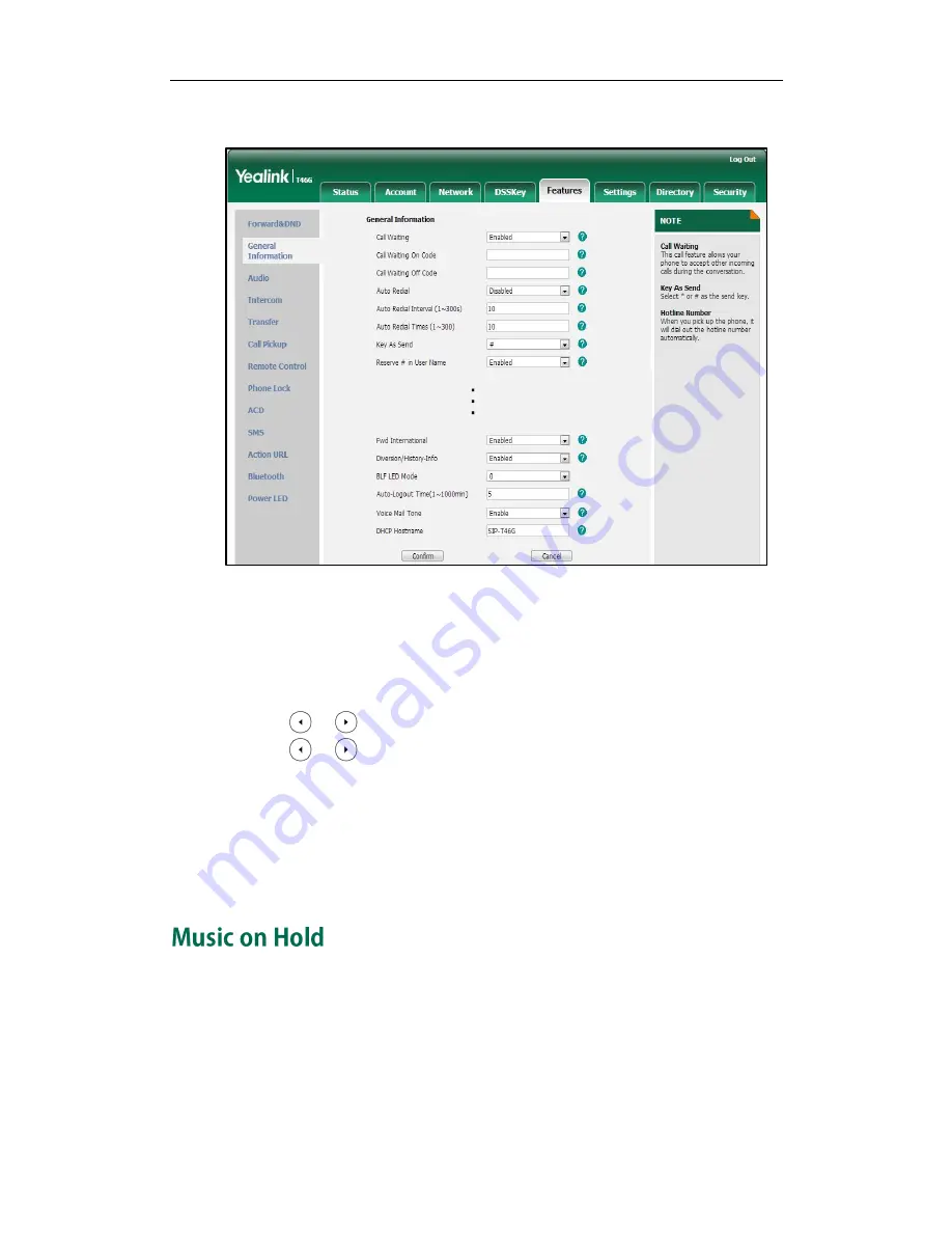 Yealink SIP-T4X Administrator'S Manual Download Page 161