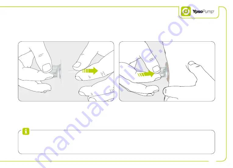 Ypsomed YpsoPump User Manual Download Page 105