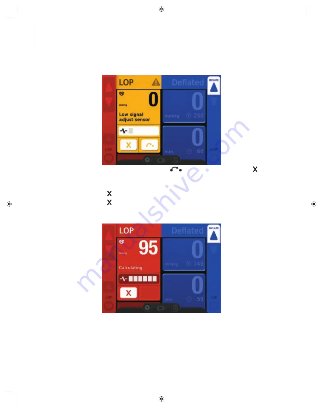 Zimmer A.T.S. 4000TS Operators & Service Manual Download Page 34