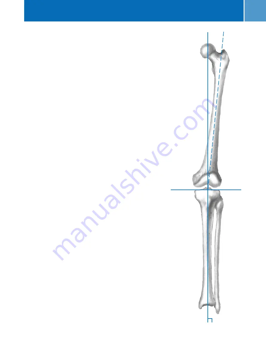 Zimmer MIS Multi-Reference Surgical Technique Download Page 7