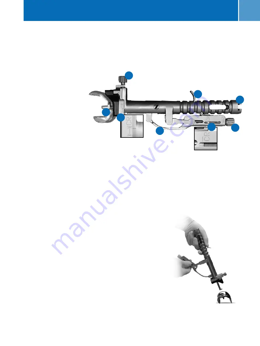 Zimmer MIS Multi-Reference Surgical Technique Download Page 37